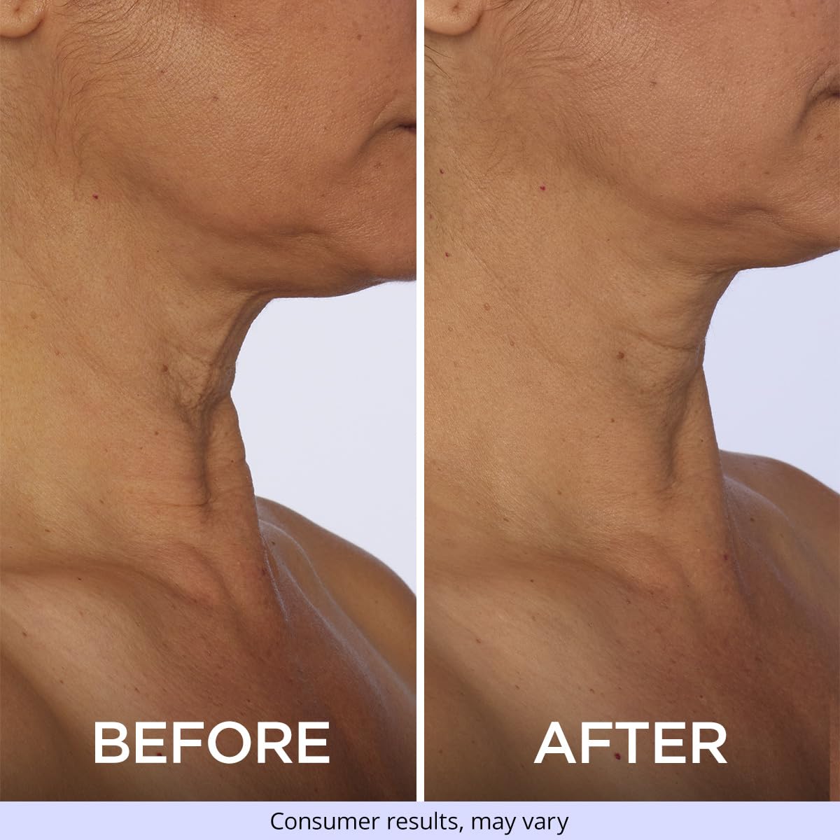 NeckLift Pro Tighten & Lift Neck Cream