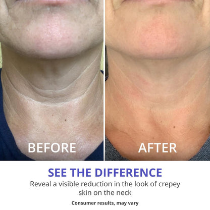 NeckLift Pro Tighten & Lift Neck Cream