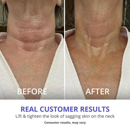 NeckLift Pro Tighten & Lift Neck Cream